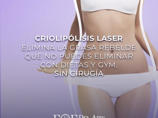 Criolipolisis laser